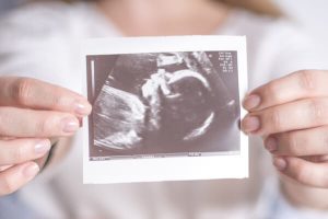 3 faktorët kryesorë për suksesin e IVF-së në rastet komplekse të infertilitetit